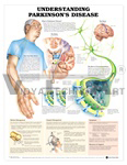 Understanding Parkinson's Disease Anatomical Chart, 1st Edition - Laminated